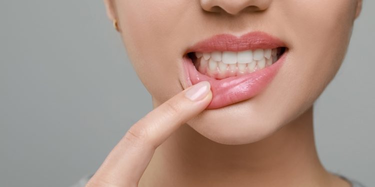 Entenda por que no inverno os dentes podem ficar mais sensíveis