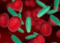 Hematologista explica por que a anemia é mais comum em mulheres