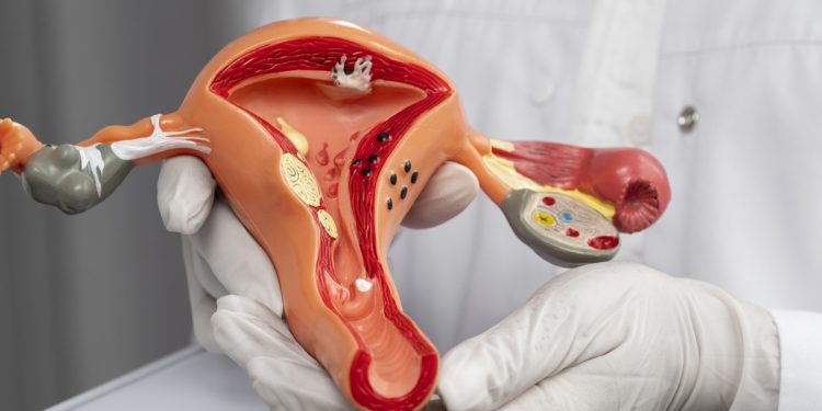 DNA-HPV: exame para rastrear câncer de colo do útero chega a 59 UBSs