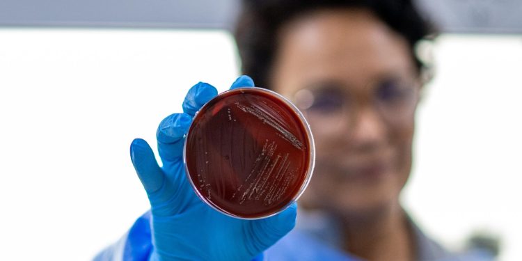 Diretora do Lacen explica como bactéria foi detectada em lote da Água Crystal