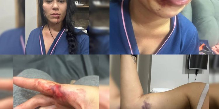 Juiz diz que mulher esganada não sofreu tentativa de feminicídio, “apenas” violência doméstica