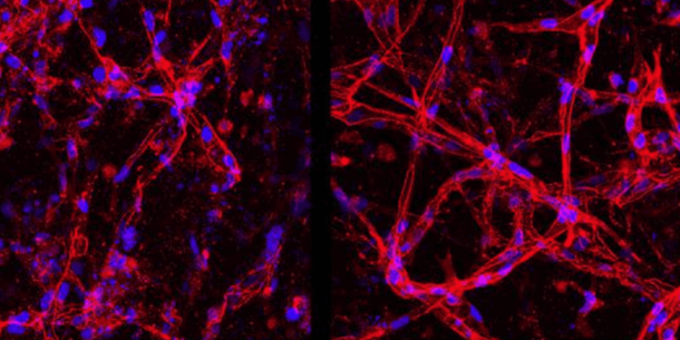 Cientistas criam células da retina em laboratório para tratar cegueira