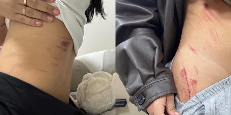 Casal lésbico narra momentos de horror durante estupro: “Queria o nosso desespero”
