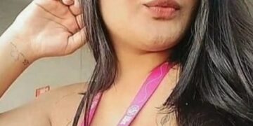 Jovem de 23 anos faz vaquinha para custear tratamento de câncer