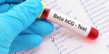 Teste de alergia em farmácias: entenda os riscos do autodiagnóstico