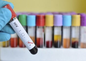 Cientistas acham mutação genética que pode limitar replicação do HIV