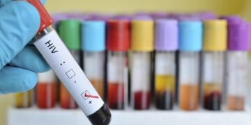 Cientistas acham mutação genética que pode limitar replicação do HIV