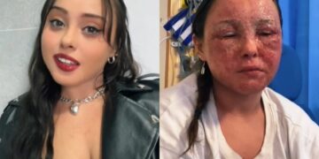 Olhos de bebê mudam de cor após tratamento contra Covid