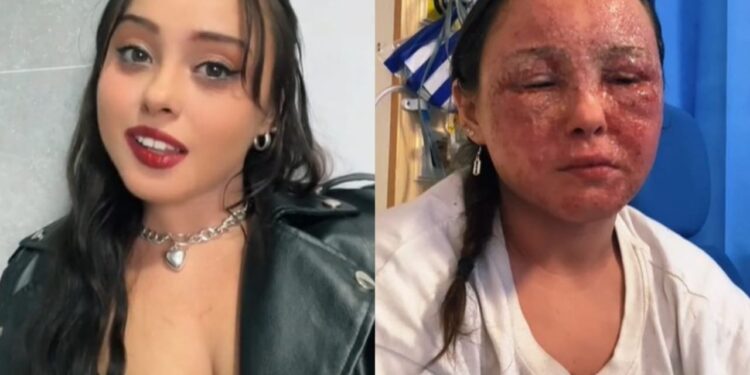 Olhos de bebê mudam de cor após tratamento contra Covid