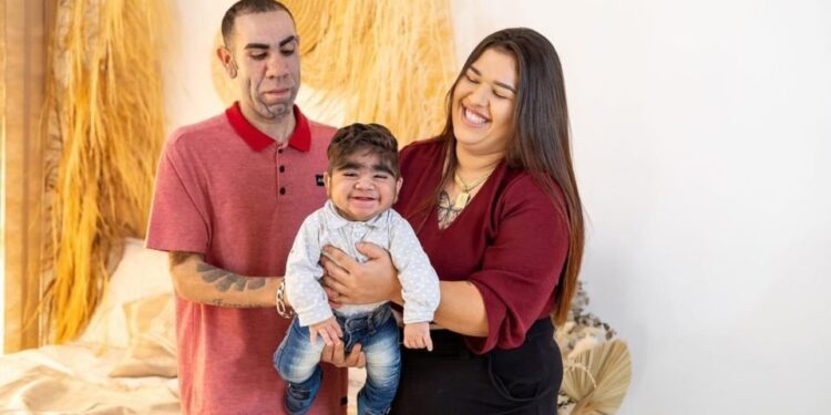 Bebê brasileiro que nasceu com barba viraliza no TikTok. Vídeo