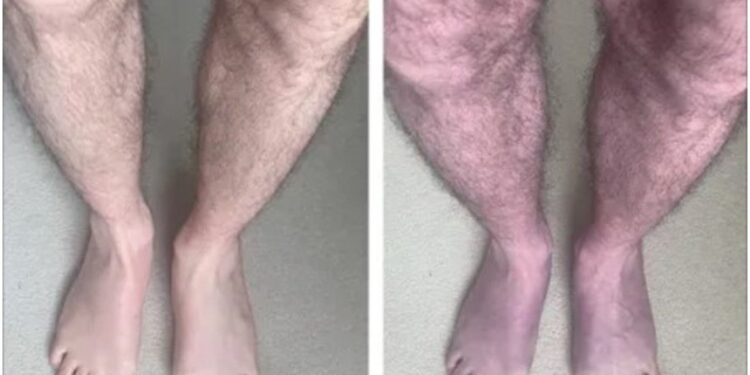 Covid longa é mais severa em idosos e também mais difícil de apontar