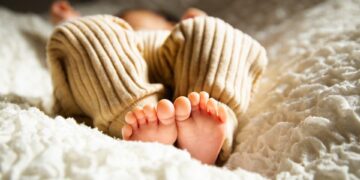 Teste da linguinha em recém-nascidos: quando a frenotomia é indicada?