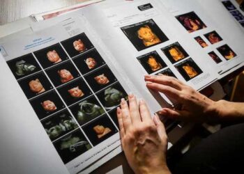 Fofura: bebê fruto de “milagre” começa a dizer as primeiras palavras