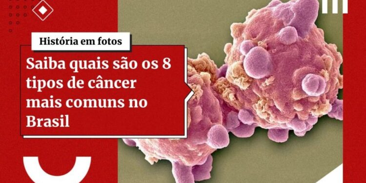 Câncer do colo do útero: estudo traz avanços pela 1ª vez em 20 anos