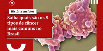 Maioria dos pais não conhece sintomas de câncer infantil. Veja lista