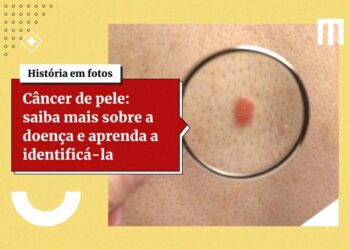 Skincare: veja 5 erros comuns que causam danos à pele