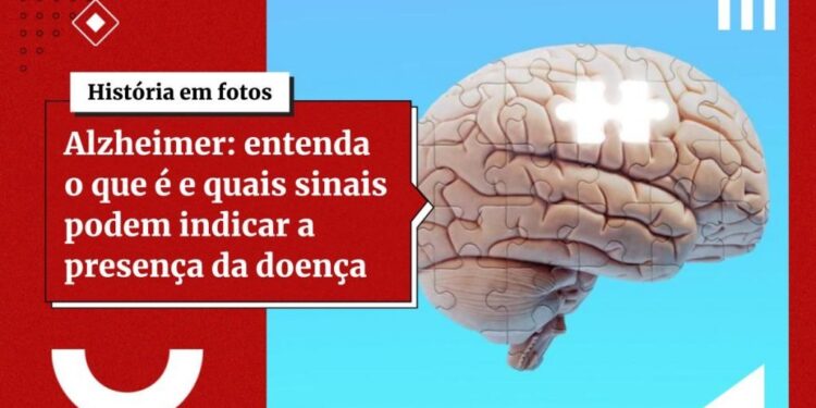 Estudo: tabagismo, obesidade e sedentarismo afetam declínio cognitivo