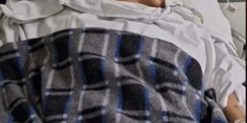 Jovem é internada com falta de ar e acaba com braço amputado. Entenda