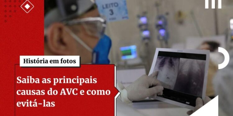 Inédito! Cientistas criam impressão 3D para reparar lesões cerebrais