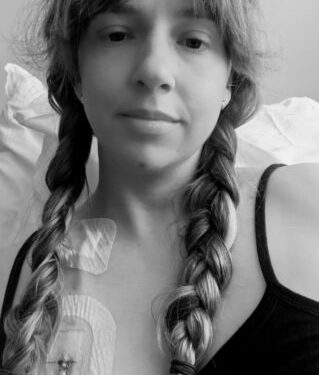 Mulher que atribuía manchas roxas à distração descobre ter anemia rara