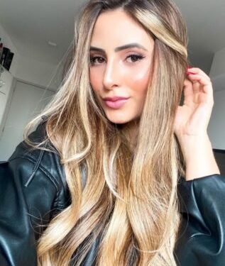 “Não me reconhecia mais”, conta influencer que fez quatro plásticas