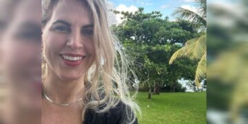 Empresária diz ter rejuvenescido 27 anos com terapia experimental