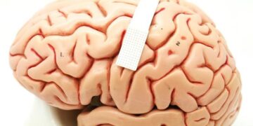 Cientistas americanos criam implante cerebral capaz de ler pensamentos