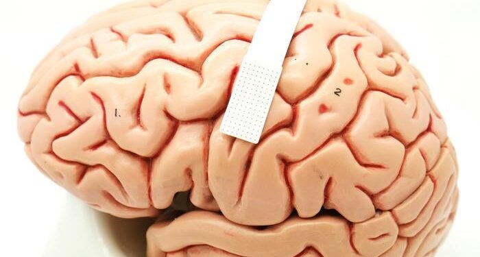 Cientistas americanos criam implante cerebral capaz de ler pensamentos