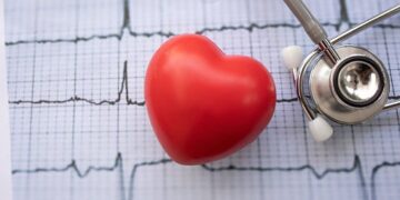 Arritmia cardíaca: o que é, quais são os sintomas, como evitar