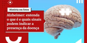 Proteína príon: achado pode ajudar a tratar doenças neurodegenerativas