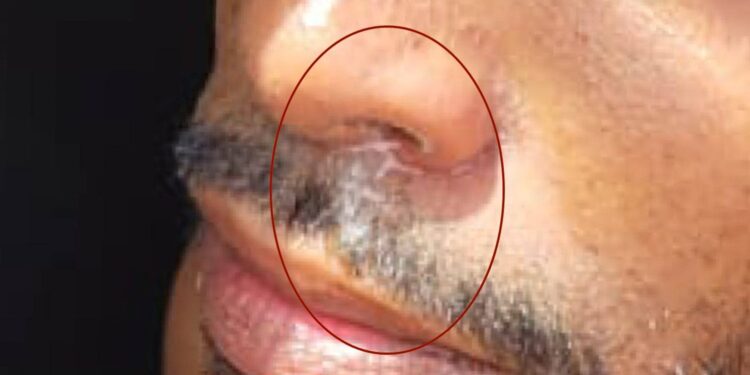 Com nariz sujo de pó, homem é preso após “cavalo de pau” ao lado de DP