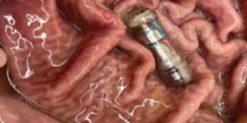 Pílula de Harvard aumenta saciedade e faz comer 40% menos, diz estudo