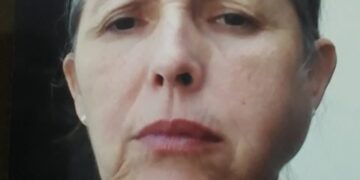 “Sentia dor até para me alimentar”, diz mulher com síndrome de Sjögren