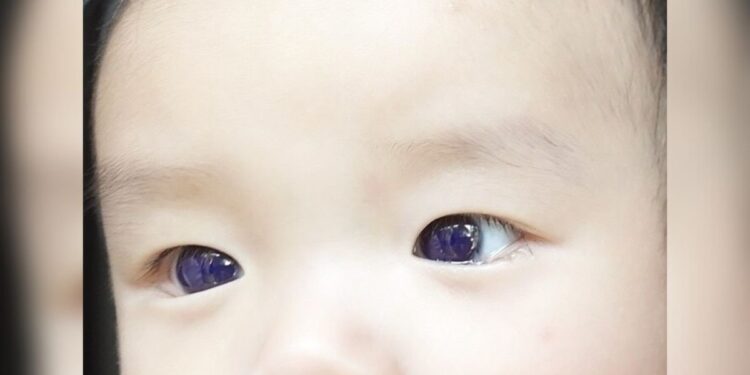 Retrospectiva: relembre os casos médicos mais bizarros de 2023