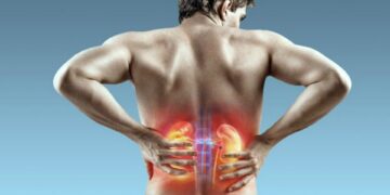 Previna-se: incidência de pedra nos rins tende a aumentar 30% no verão