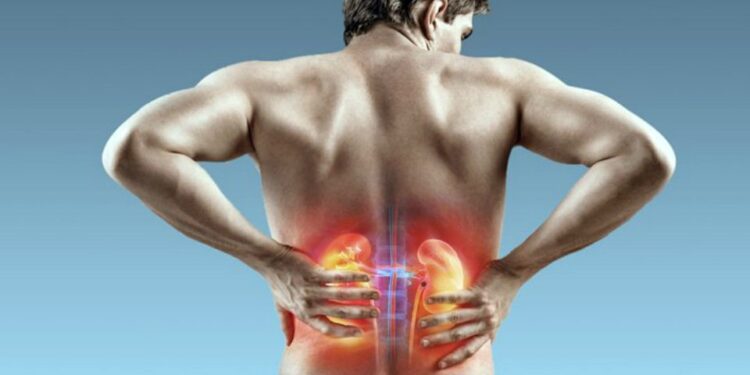 Previna-se: incidência de pedra nos rins tende a aumentar 30% no verão