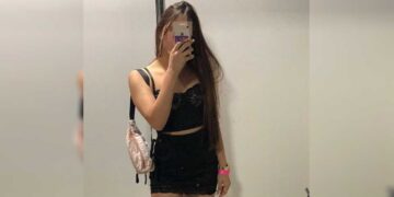 Escalpelada por kart iria escolher vestido de formatura nesta semana