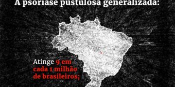 Conheça doença rara de pele que poucos médicos conseguem diagnosticar