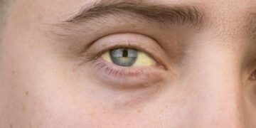 Você sabe por que o seu xixi é amarelo? Ciência explica a cor da urina