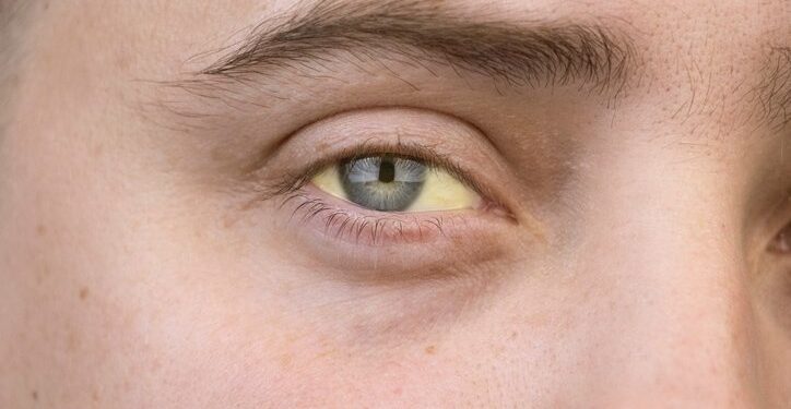 Você sabe por que o seu xixi é amarelo? Ciência explica a cor da urina