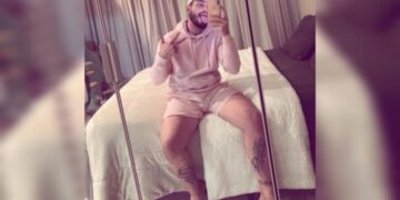 Situs inversus: homem conta como é viver com órgãos do lado contrário