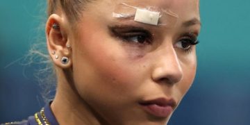 Ginasta Flávia Saraiva sofre queda e corta supercílio