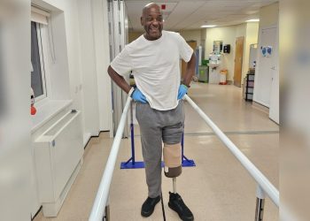 Homem queima os pés em casa e acaba tendo que amputar a perna. Entenda