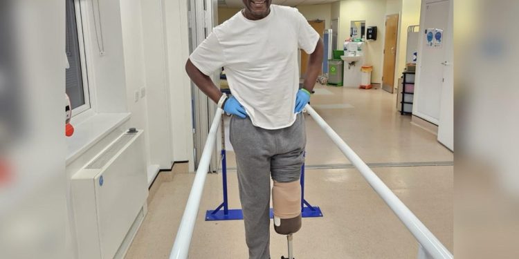 Homem queima os pés em casa e acaba tendo que amputar a perna. Entenda