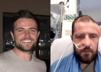 “Meu cérebro girou no crânio”, diz jovem atropelado por homem bêbado