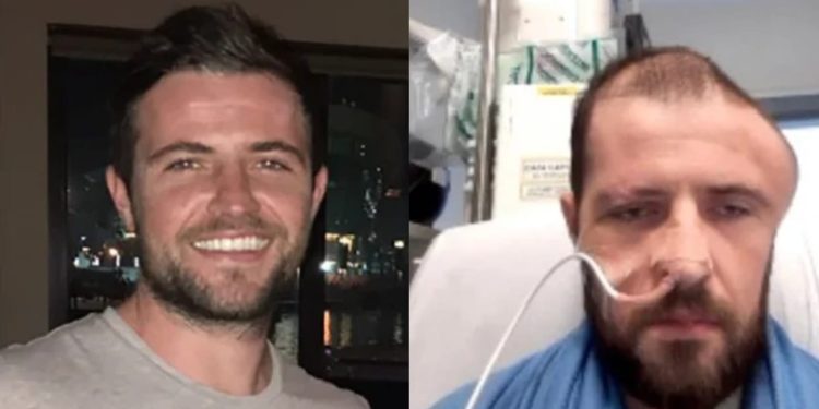 “Meu cérebro girou no crânio”, diz jovem atropelado por homem bêbado