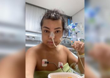 “Bariátrica foi um engano”, diz mulher após fazer a reversão