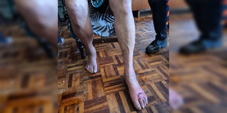 Veja como mãe foi encontrada ferida e trancada por filho na Asa Sul