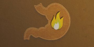 Gastrite: o que excluir da dieta ou incluir para evitar crises