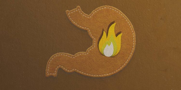 Gastrite: o que excluir da dieta ou incluir para evitar crises